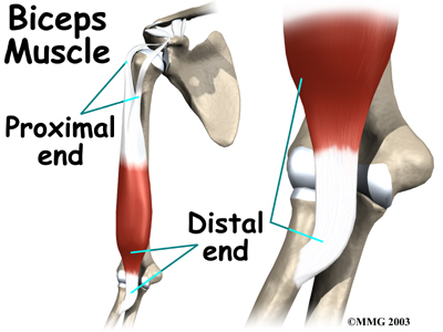 Distal Biceps Repair